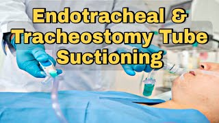 Mastering Endotracheal amp Tracheostomy Tube Suctioning StepbyStep Guide [upl. by Ardnasac543]