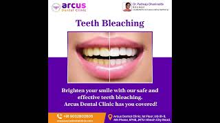 Best Teeth Whitening Treatment in KPHB HYD  Teeth Bleaching  Arcus Dental Clinic whiteteeth [upl. by Submuloc]