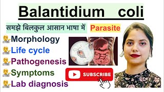 Balantidium coli in Hindi  Parasite  Morphology  Life Cycle  Symptoms  Hindi  Parasitology [upl. by Kola]