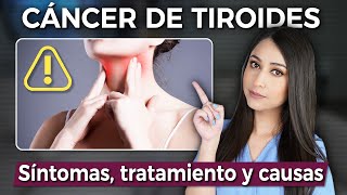 ¿Qué síntomas causa el CÁNCER DE TIROIDES y cuál es el TRATAMIENTO👩🏻‍⚕️ drapauzuniga [upl. by Weiler]