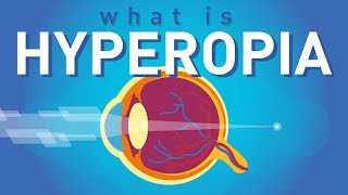 What is Hyperopia Farsightedness [upl. by Eiralam]