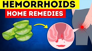 Say Goodbye to Hemorrhoids 8 Home Remedies That Actually Work [upl. by Sayette]