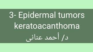 3 Epidermal tumors 👉 keratoacanthoma by Dr Ahmed Anany [upl. by Rudin467]