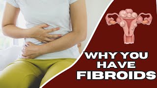 Uterine Fibroids  Causes  Symptoms  Diagnosis  Treatments [upl. by Eiresed]