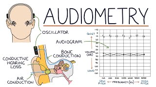 Understanding Audiometry and Audiograms [upl. by Aenad445]