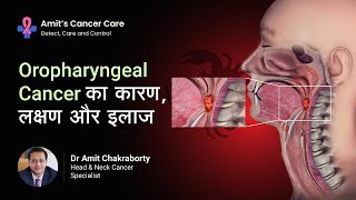 Oropharyngeal cancer  Causes symptoms amp treatment  Explained by Dr Amit Chakraborty [upl. by Descombes119]