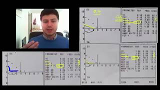 Spirometrie 6  exemple DVM disfunctie ventilatorie mixta [upl. by Kielty]