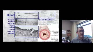 Bronchitis and Asthma 2 [upl. by Nur]