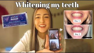 TESTING CREST 3D WHITESTRIPS  honest review [upl. by Antonina664]