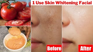 1 Time👆Skin Whitening Tomato Facial1 बार में निखर जाएगी रंगत दाग धब्बे होंगे साफ़ चमक उठेगा चेहरा [upl. by Analos701]