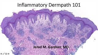 Inflammatory Dermpath 101 A Beginners Guide to Diagnosing Skin Rashes for NonDermatopathologists [upl. by Nahsrad119]