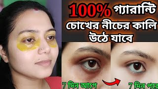 চোখের নিচের কালি দূর করার উপায়Chokar tolar kali dur korar upayHow to remove under eye gel [upl. by Eiveneg666]