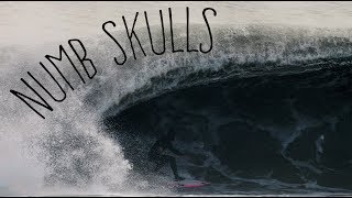 Numb Skulls New Jersey [upl. by Ahtennek174]