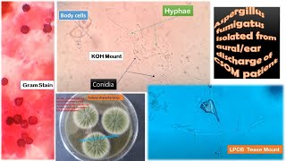 Aspergillus fumigatus Isolated from clinical specimen [upl. by Nyrad]