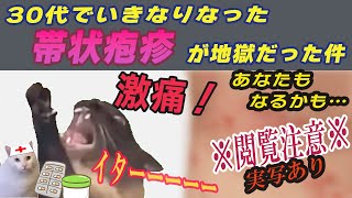 30代でいきなりなった帯状疱疹が地獄だった件！激痛！あなたもなるかもしれません！！ ※実写あり 閲覧注意 [upl. by Ainyt485]