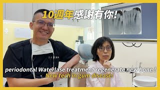 Periodontal Waterlase treatment regenerate new bone New tech in gum disease [upl. by Anitsyrk]