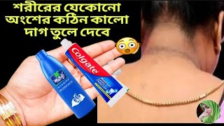 নারকেল তেল ও শ্যাম্পু মিশিয়ে এভাবে লাগান একদিনে হা পা ধবধবে ফর্সা উজ্জ্বল হবে Coconut Oil Facial [upl. by Aggie]