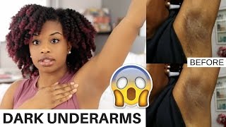 How To Lighten Dark Underarms Naturally and Fast  BEFORE AND AFTER RESULTS  journeytowaistlength [upl. by Ibot]