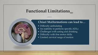 Chiari Malformations [upl. by Russian]