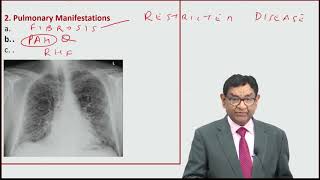 MRCP  Systemic Sclerosis  Lectures by Dr Bhatia [upl. by Nohpets186]