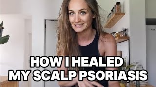 How I healed my scalp psoriasis and you can too  Diet tips hair oiling [upl. by Drarej]