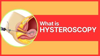 What is Hysteroscopy By Dr Mudita Jain [upl. by Lemart55]