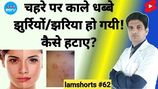 चहरे पर काले धब्बे झुर्रियों तथा झाइया हो गयी कैसे हटाए Shorts lamshorts [upl. by Rianna805]