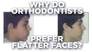 Orthodontics flattens your face [upl. by Oelak]