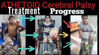 Athetoid Cerebral Palsy During treatment progress  Adult Cerebral Palsy Patient [upl. by Ilanos534]