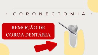 REMOÇÃO SOMENTE DA COROA DO DENTE  Resumos de Odonto [upl. by Ahsenwahs]