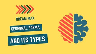 Cerebral Edema and its types  Dream Max [upl. by Asilrak]