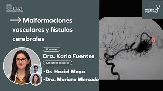 Malformaciones vasculares y fístulas cerebrales por la Dra Karla Fuentes [upl. by Nnaxor]