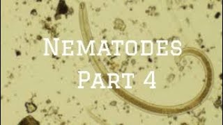 Intestinal Nematodes Ancylostoma and Necator microbiology nematode [upl. by Eatnom417]