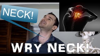 Wry Neck  Torticollis Causes amp SCM Stretch Info [upl. by Dnalyram]