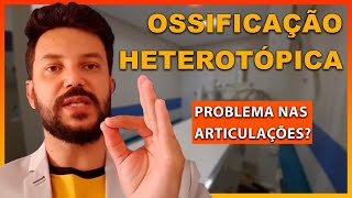 OSSIFICAÇÃO HETEROTÓPICA  FIQUE ATENTOA [upl. by Sucramrej475]