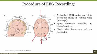 10 Fundamentals of EEG and applications [upl. by Aicyle]