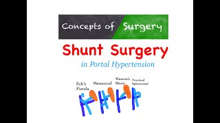 Shunt Surgeries in Portal Hypertension [upl. by Hgielsa]