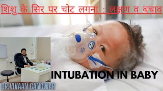 Gasping Condition In Baby  Paediatric Intubation  Intubation Procedure In Newborn  Intubation [upl. by Yelrebma711]