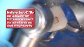 Dentsply EndoZ Bur  Review by Dr Scott Norton [upl. by Llerad]