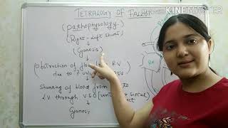 quotTetralogy of fallotquot CYANOTIC CONGENITAL HEART DISEASE PART 1 [upl. by Nailimixam]