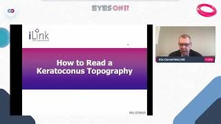 Keratoconus Game Changer What ODs Need to Know About CrossLinking [upl. by Hartmann]