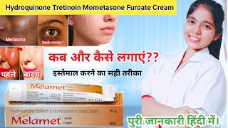 Hydroquinone tretinoin mometasone furoate cream  Melamet Cream Ki Jankari  Drx Pranjali Satpute [upl. by Adnolrehs]