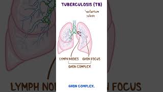 Clinical Cuts Mycobacterium tuberculosis [upl. by Renault]