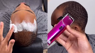 How To Fix A Balding Haircut [upl. by Richela]