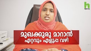 മുഖക്കുരു എളുപ്പം സുഖപ്പെടുത്താം  Pimple treatment malayalam health tips [upl. by Pippy]