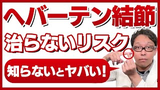 ヘバーデン結節が治らないリスクと対策TOP7【指の痛み・こぶ・変形】 [upl. by Latsyrhk]