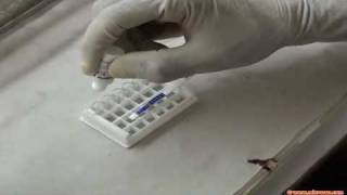 Rapid malaria test [upl. by Howlond]