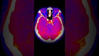 Neanderthal Brains Were Different [upl. by Eimmis457]