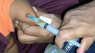 Ceftriaxone 500mg Ceftrone  amp Dexamethasone intramuscular injection Video 24 Ep 75 Injection Tips [upl. by Naicul]