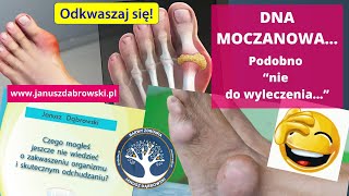 Podagra Przyczyny Objawy i Skuteczne Leczenie Dny Moczanowej [upl. by Buke]